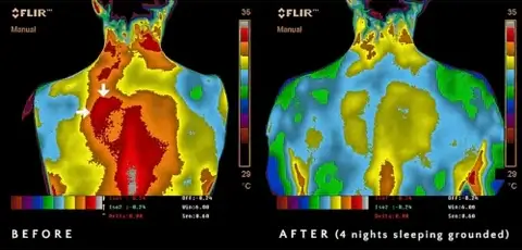 Thermal imaging showing what is grounding effects - before and after 4 nights using grounding sheets, red inflammation areas turn blue-green demonstrating grounding health benefits and how do grounding sheets work to reduce electrical deficit and inflammatory responses